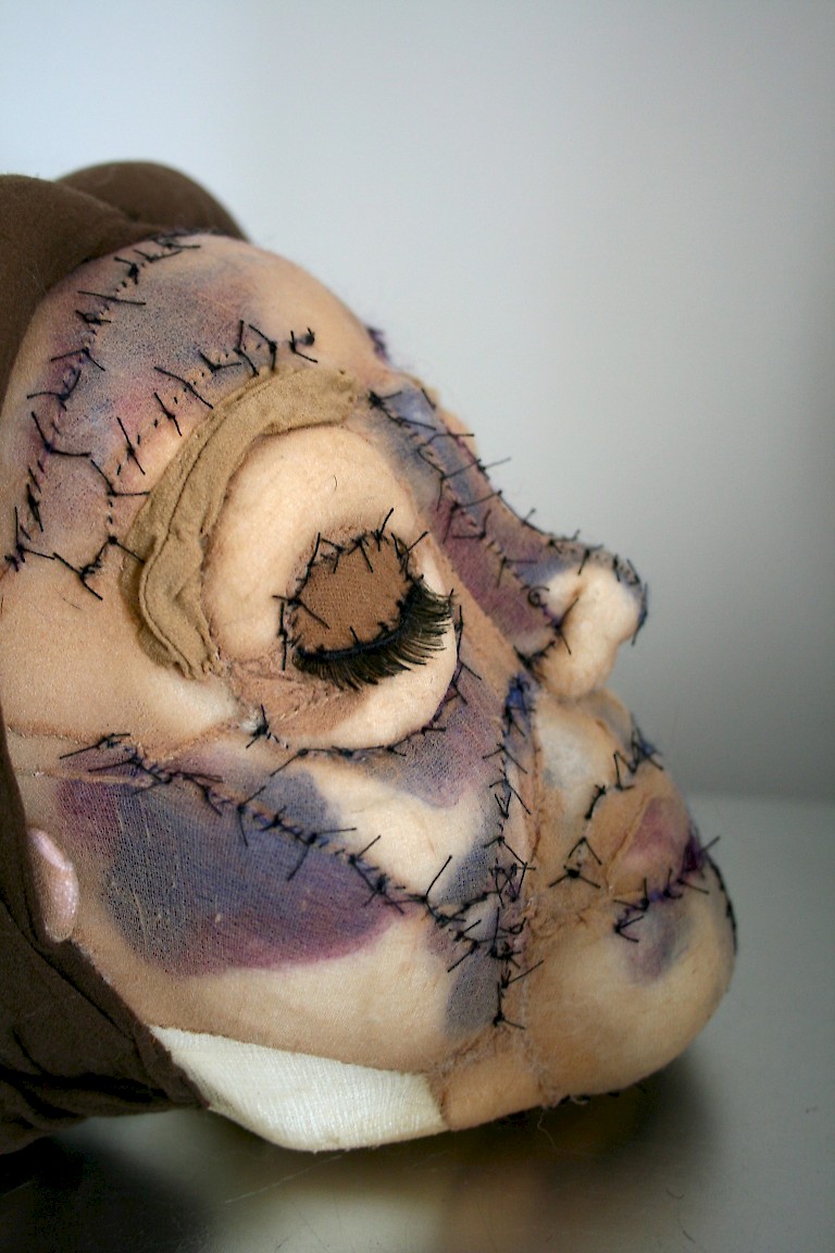 Textile work by Sue Burley, a sculpted woman's face with heavy bruising and black stitches. 